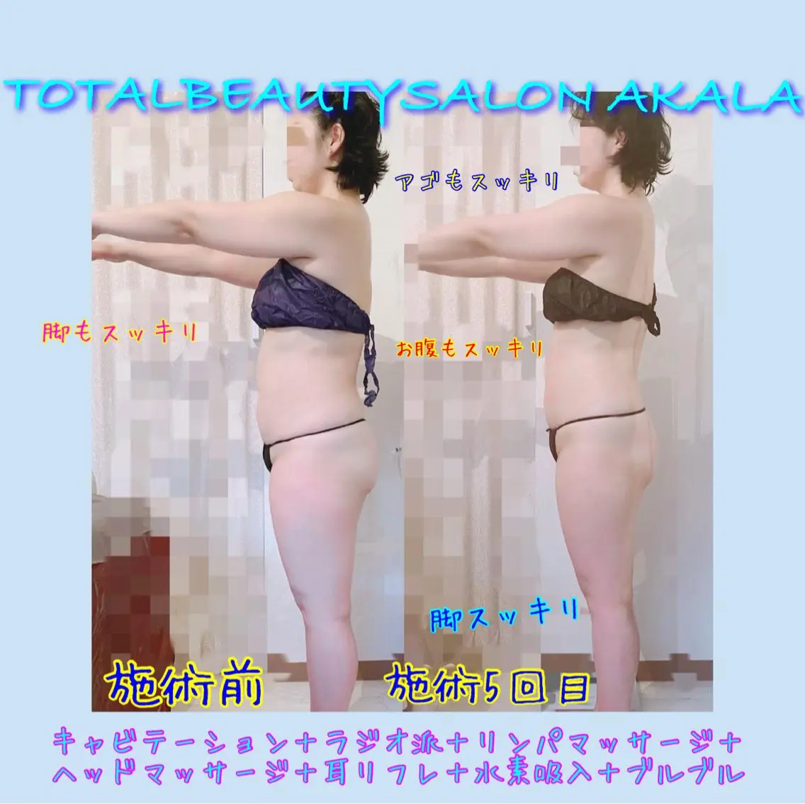 [痩せたい方限定] あっという間の180分 キャビ+ラジオ派+オイルリンパマッサージ+フィジカルキュー筋膜リリース！の写真
