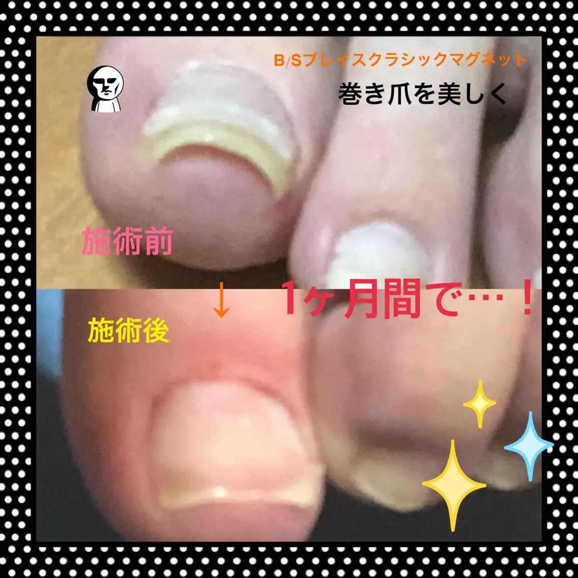 ネイル u sのネイルデザイン