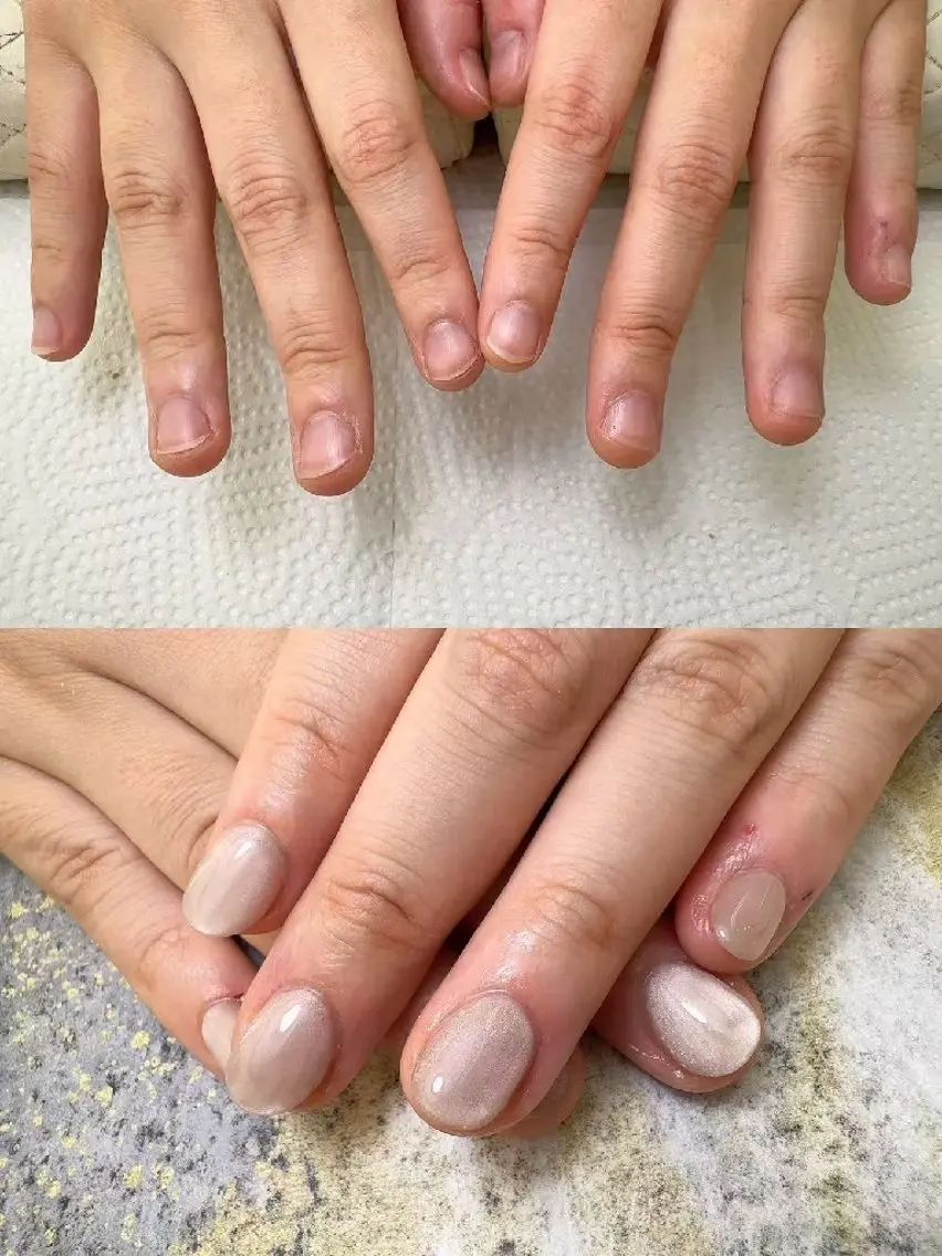 ネイル Natumiシンプル デザイン/深爪矯正のネイルデザイン