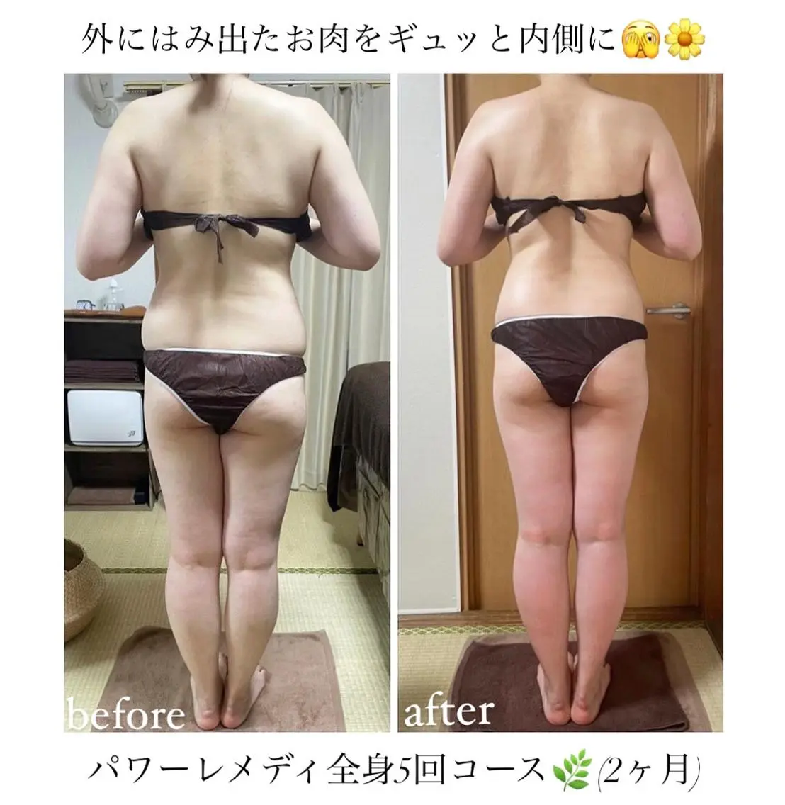 《本気痩せ×疲労改善 》 BILOOPのエステ・リラクイメージ