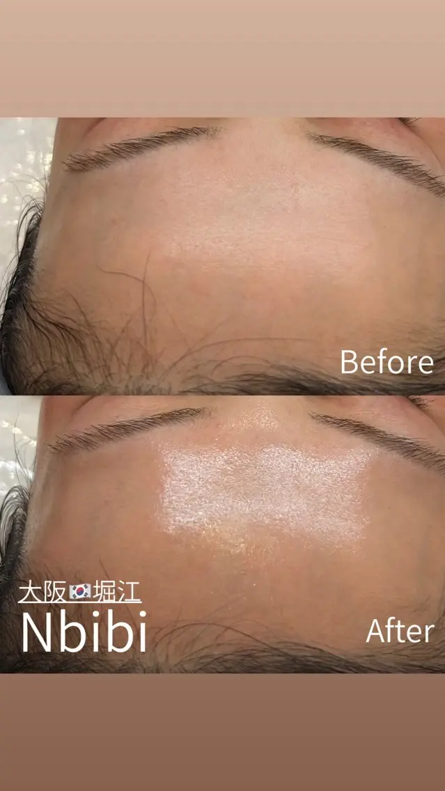 エステ 韓国🇰🇷価格 サロン_Nbibiの眉毛・アイブロウイメージ