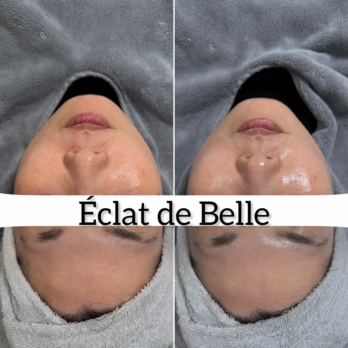 その他 Éclat de Belle🫧白玉肌のその他イメージ