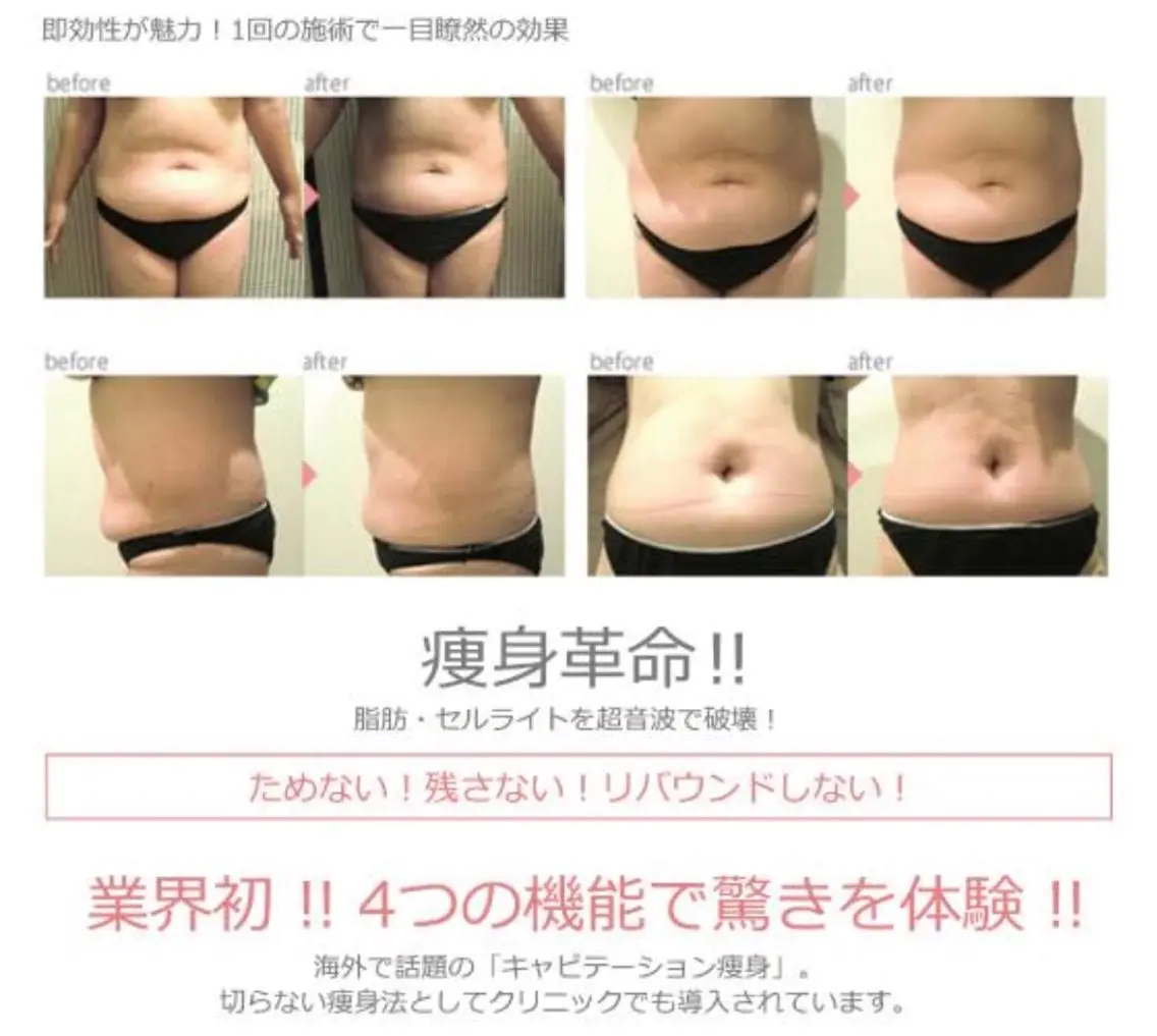 アイアンド ネイルデイのエステ・リラクイメージ