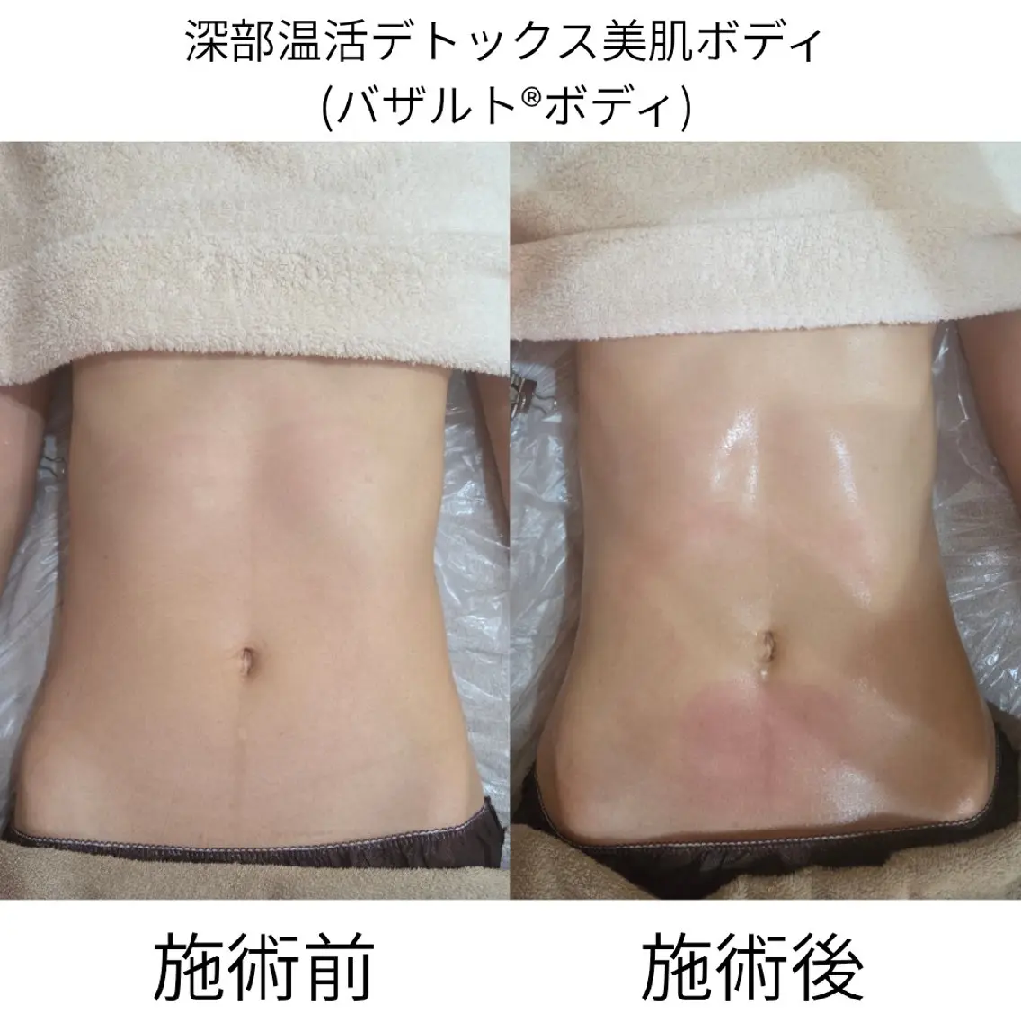 エステ リラク salon sootheのエステ・リラクイメージ