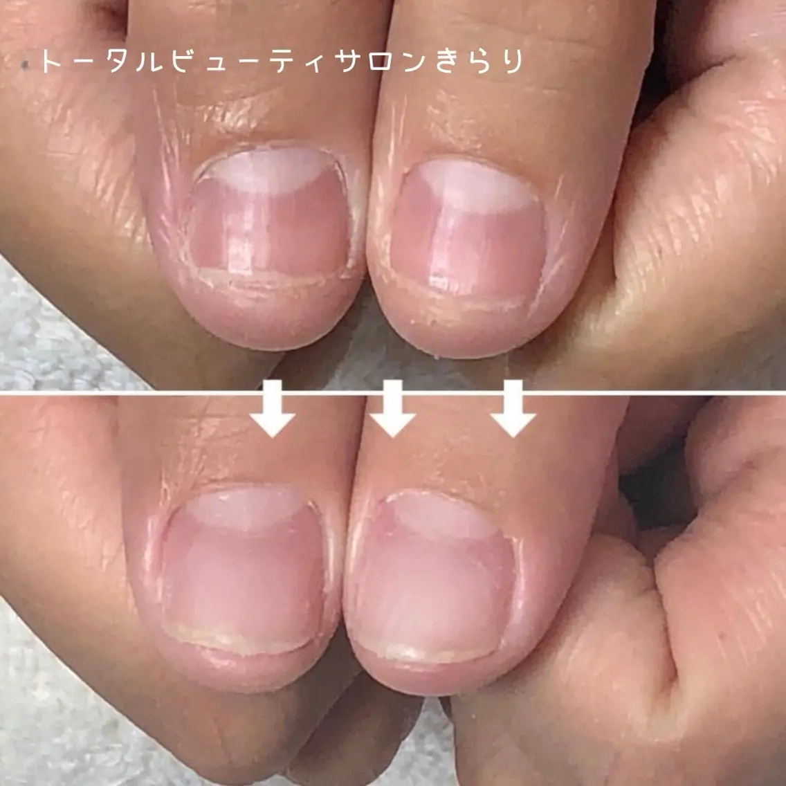 3回集中 美爪育成コースの写真
