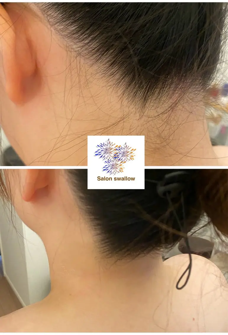 脱毛 サロンスワロー Marikoのエステ・リラクイメージ