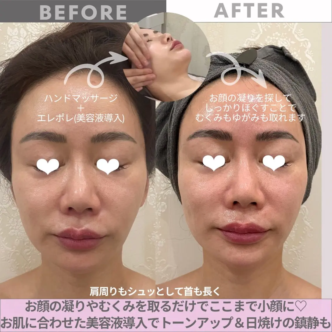 エステ リンデザ 山口のエステ・リラクイメージ