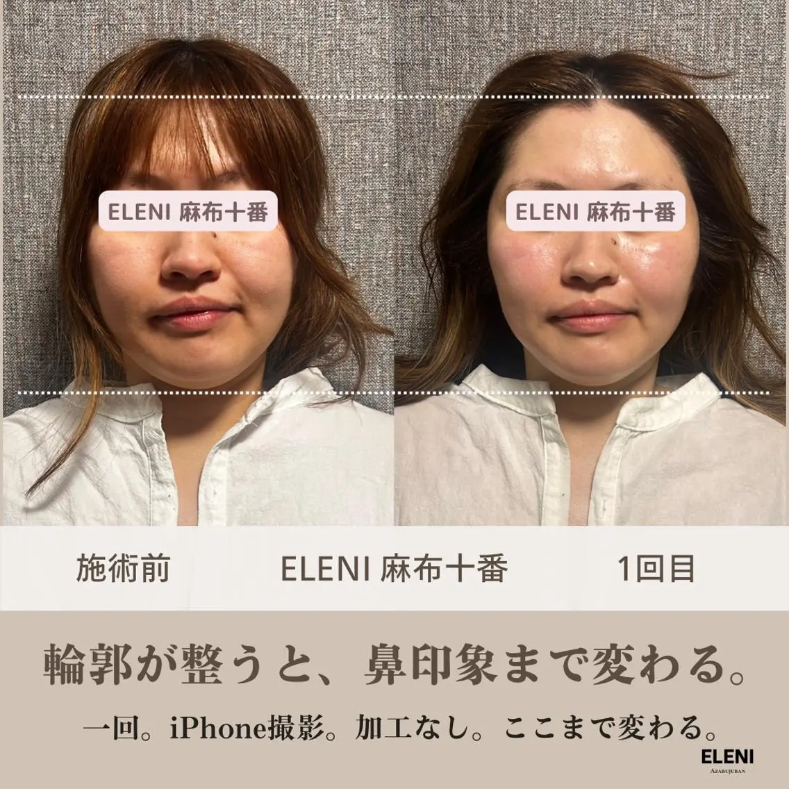 麻布十番小顔コルギ 姿勢矯正リアン💗のエステ・リラクイメージ