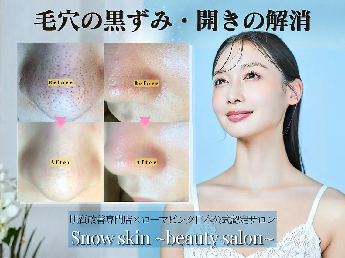 ニキビ/肌質改善専門 Snow skinのエステ・リラクイメージ