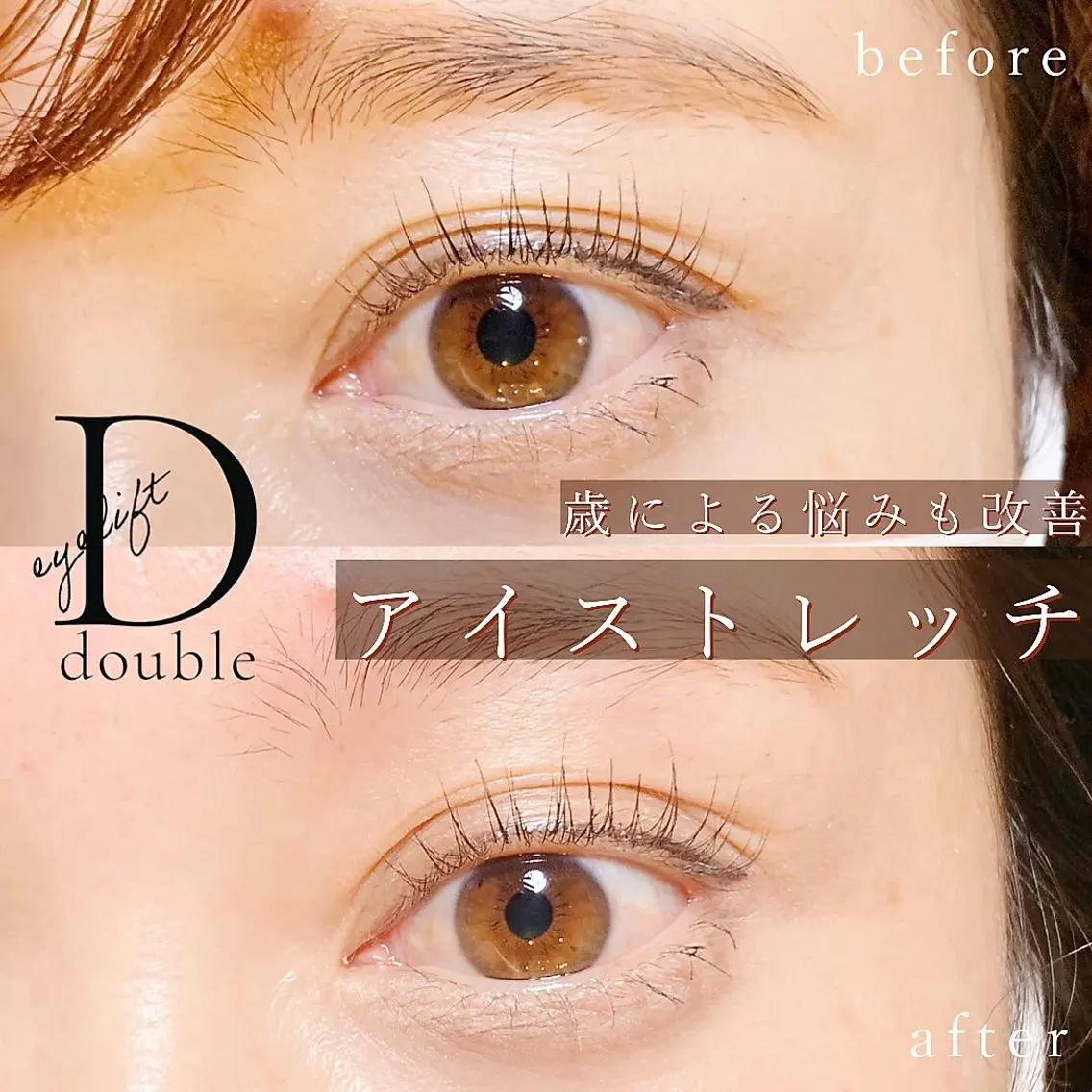 【目の疲れ、むくみを解消】アイストレッチ(骨膜マッサージ)の写真