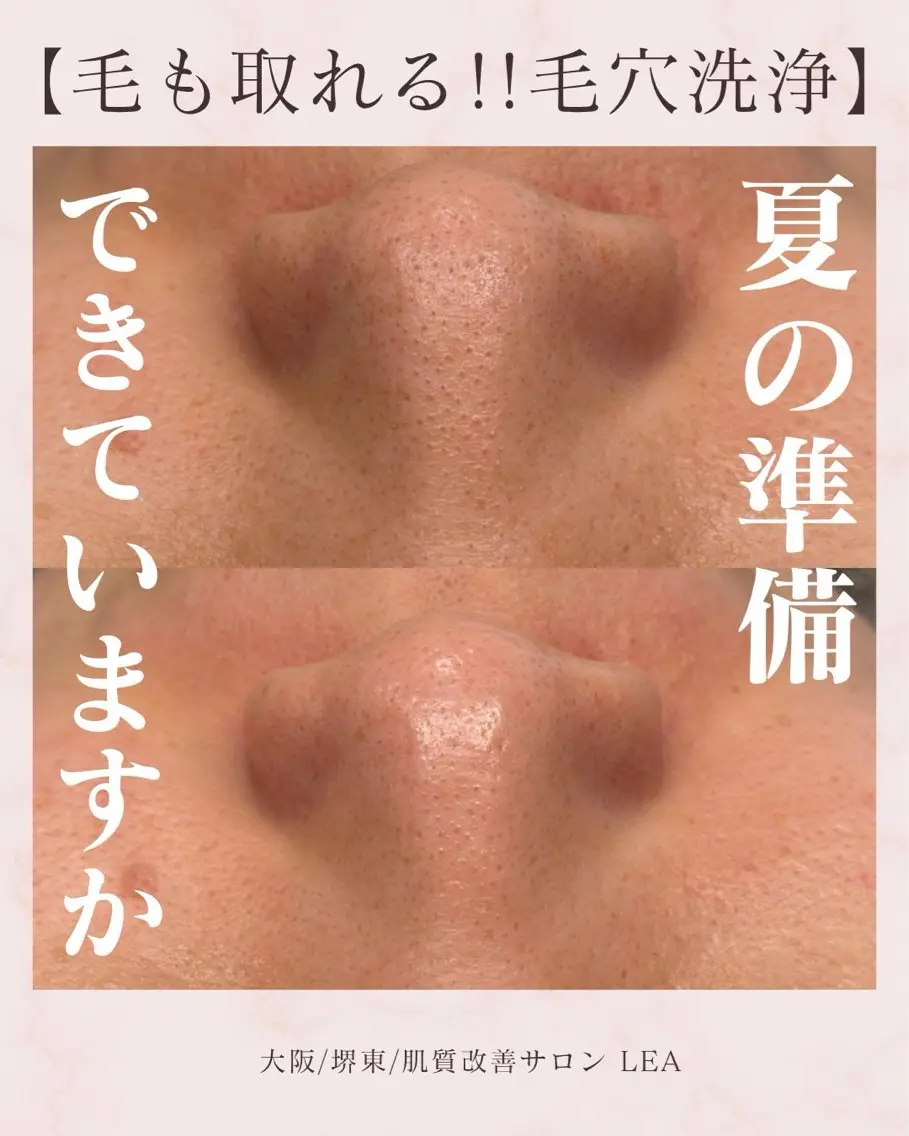 エステ Lea堺東　　眉毛| 毛穴洗浄|顔WAXのその他イメージ