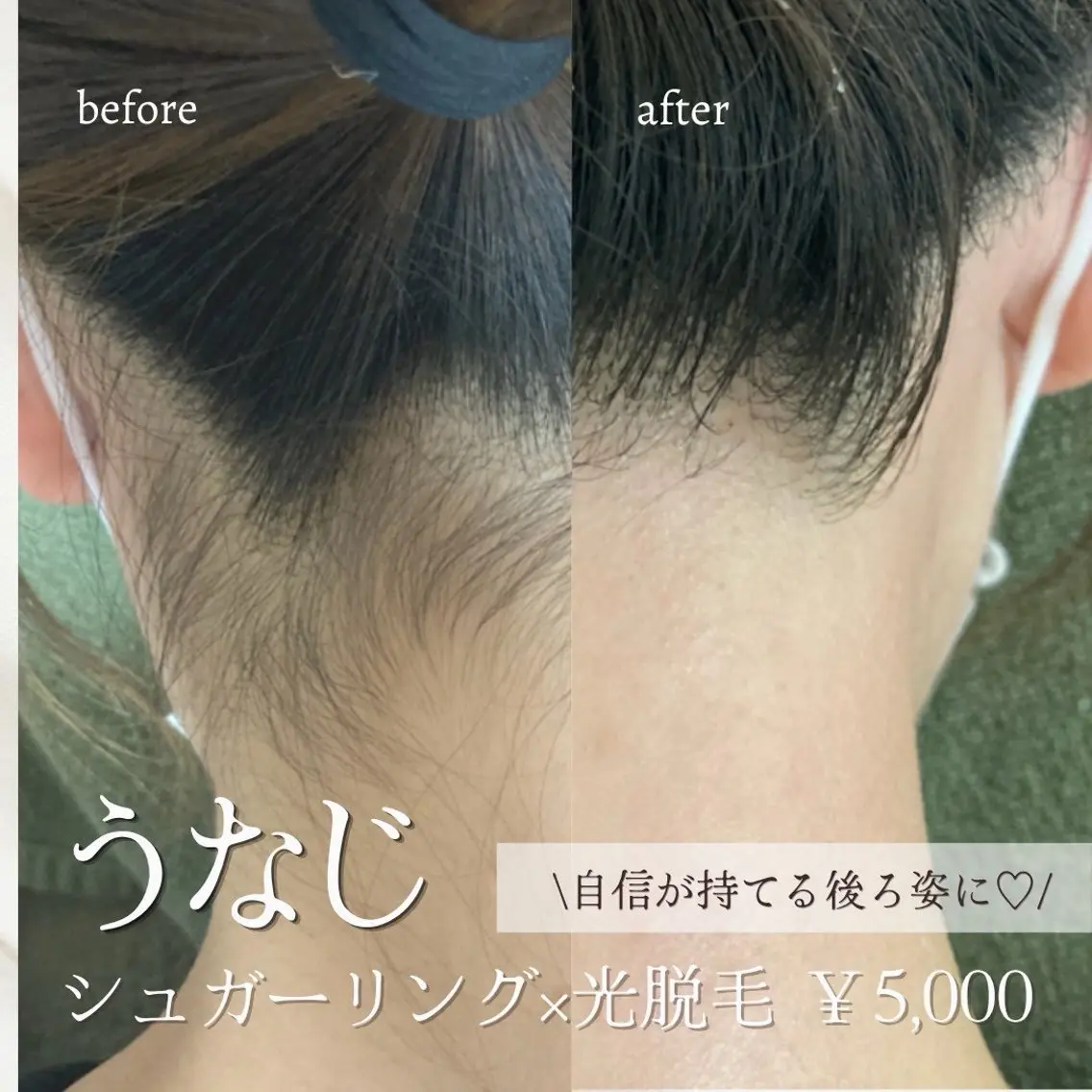 脱毛 emirai🌱 AYUMIのエステ・リラクイメージ