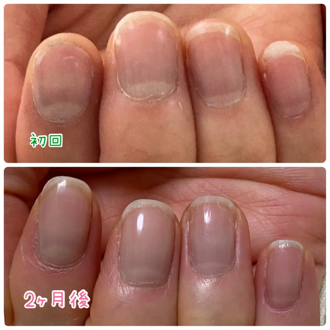 ネイル その他(ネイル) Ella nail ちゆうのネイルデザイン