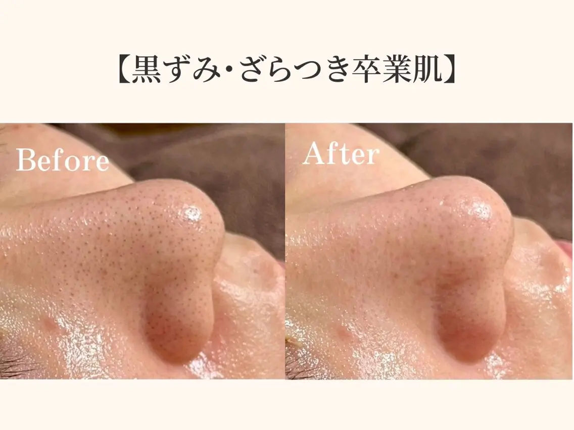 小顔矯正×毛穴サロン DRRAMSPA町田のエステ・リラクイメージ