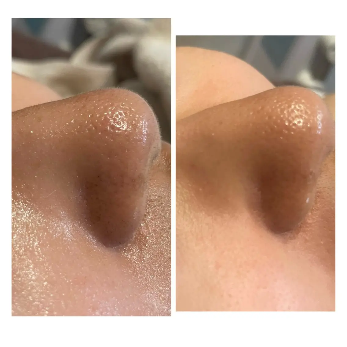 エステ Facial Salon.NANIのエステ・リラクイメージ