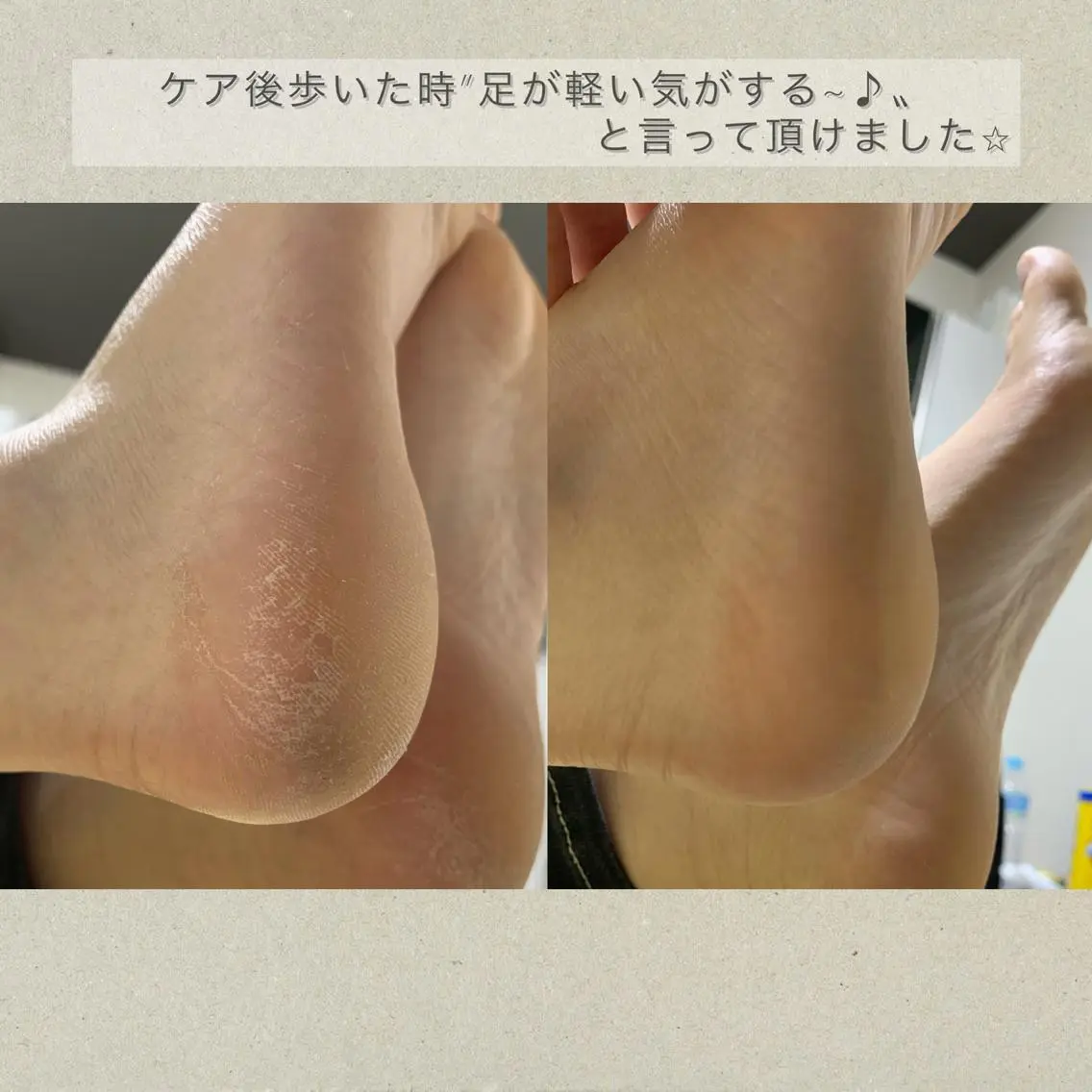 Tiara♛ティアラ 山口くるみのネイルデザイン