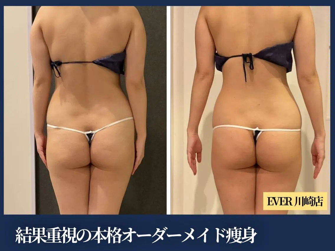 エヴァーグレース 川崎店のエステ・リラクイメージ