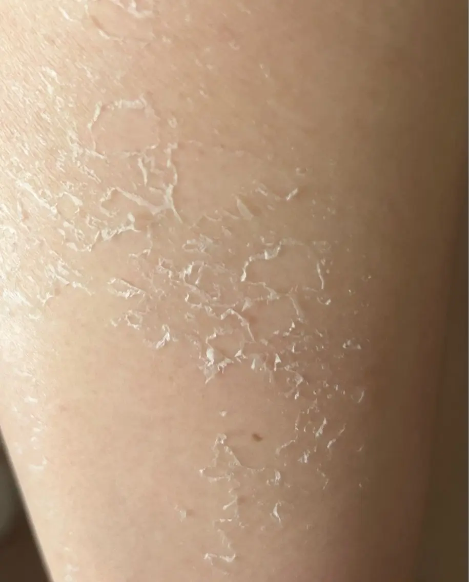エステ clé skin 🌿ハーブピーリングのエステ・リラクイメージ
