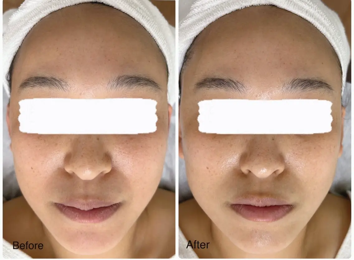 ♡美肌エステ♡ オールハンドによる癒しのフェイシャルエステ💆‍♀️お客様のお肌に合わせたお手入れと選べるパック付き🌿の写真