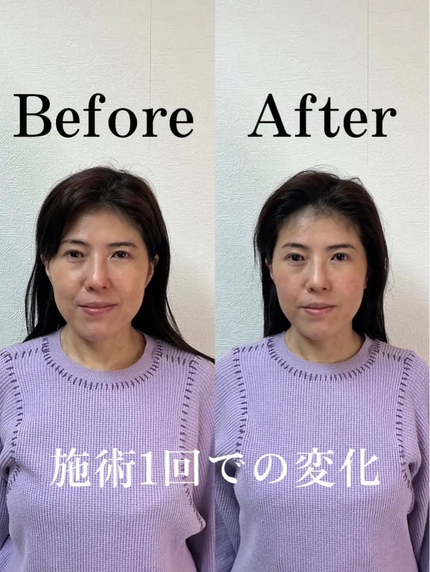 こやま りょうのエステ・リラクイメージ
