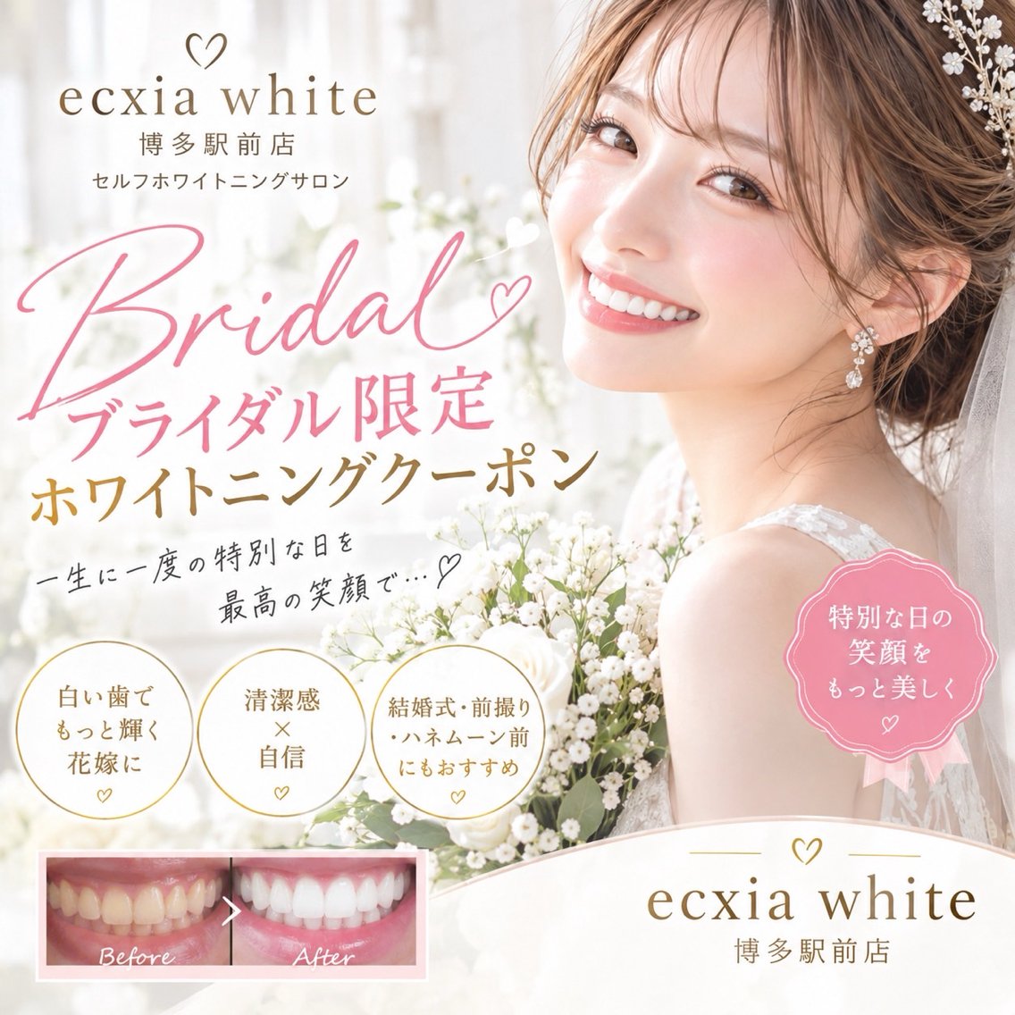 【ブライダル準備に】セルフホワイトニング(9分×2セット)1回¥1980別途料金無の写真