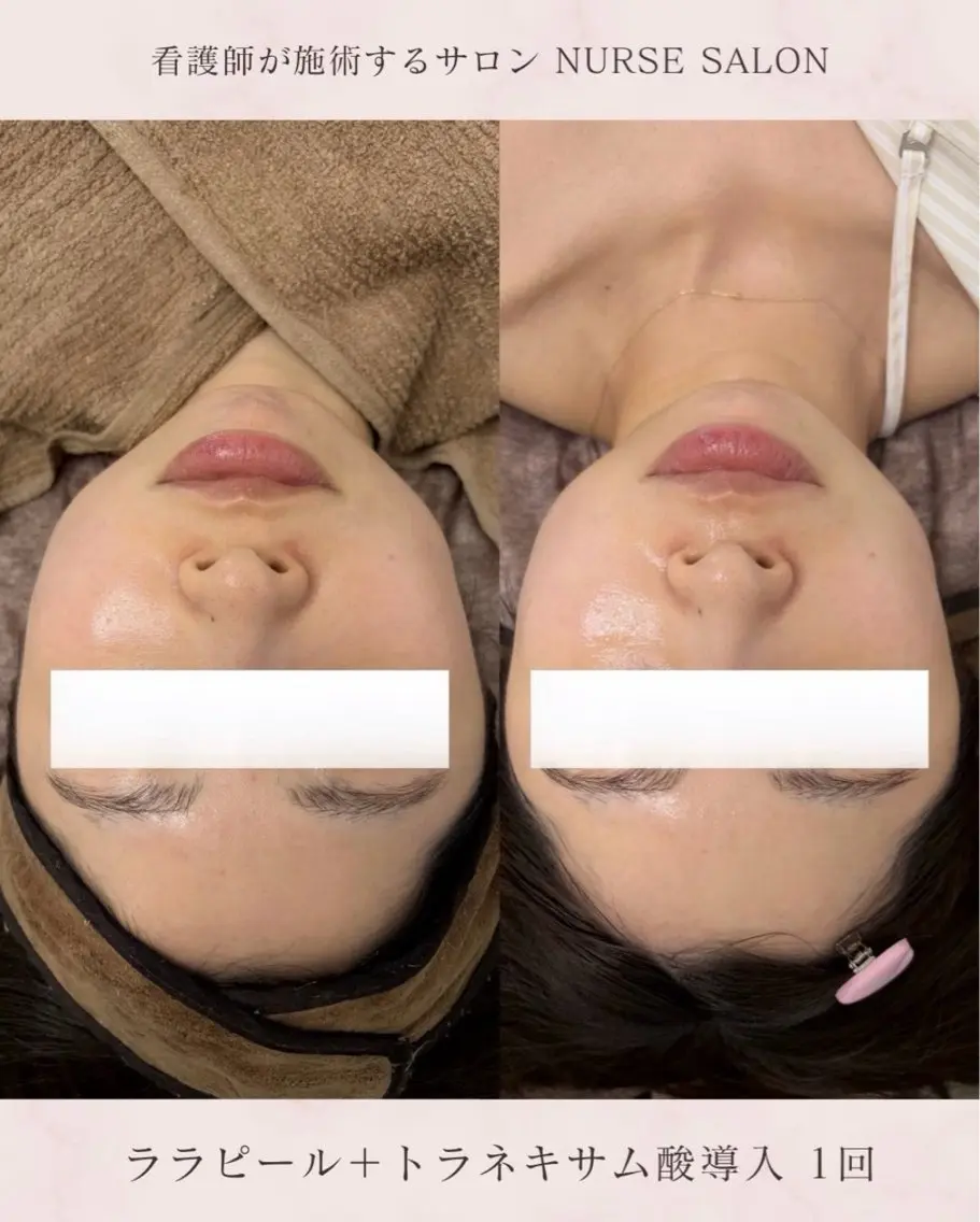 看護師が施術する美容 ナスサロ/mitoのエステ・リラクイメージ