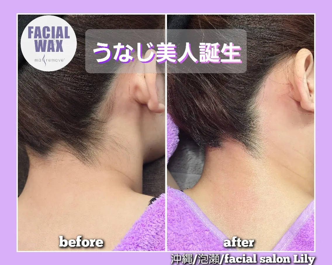 脱毛 salon Lilyのエステ・リラクイメージ