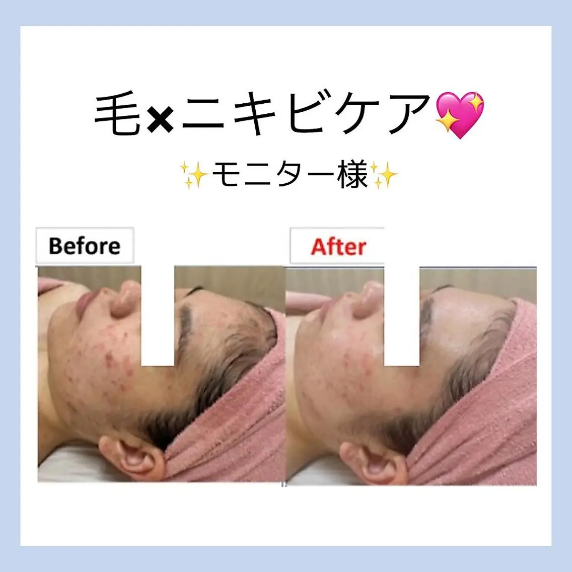 🐶レイビス 銀座店🐶simaのエステ・リラクイメージ