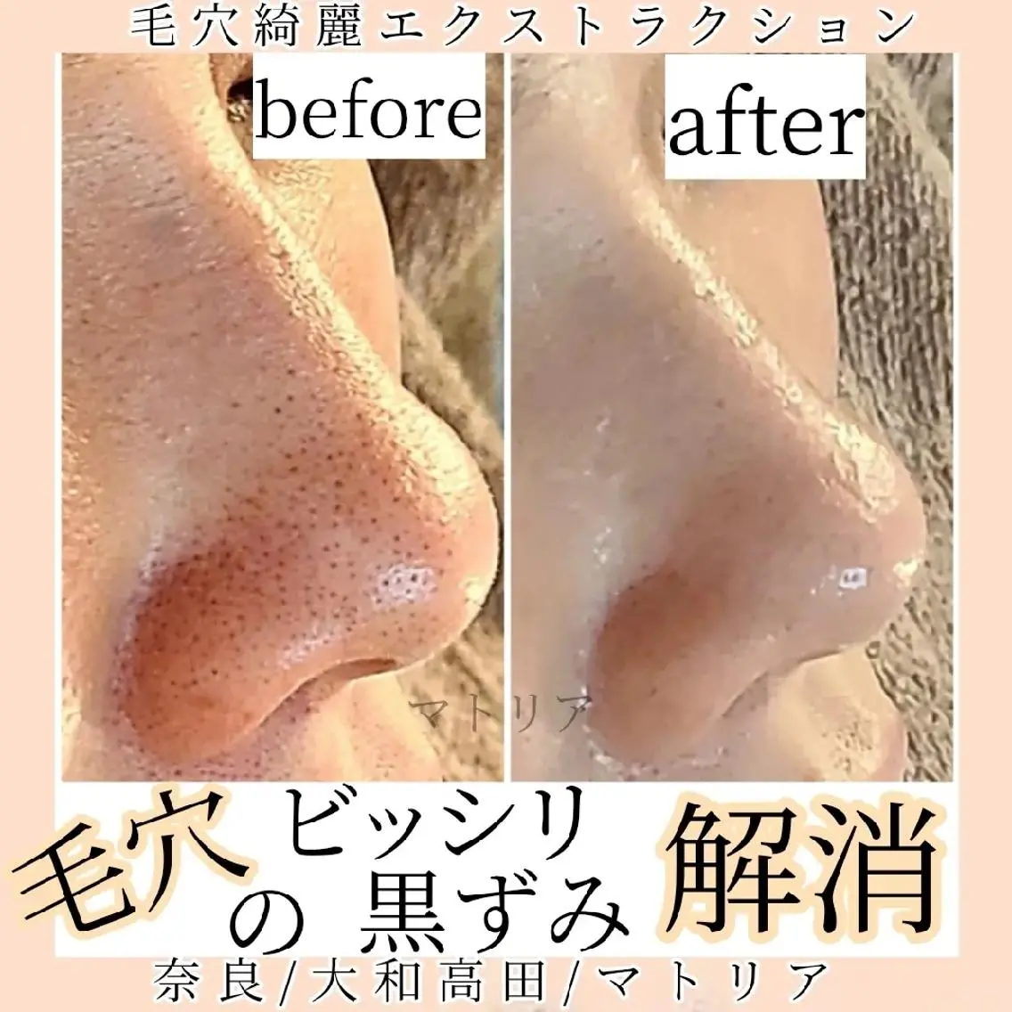 小顔 美肌専門 Matoriaのエステ・リラクイメージ