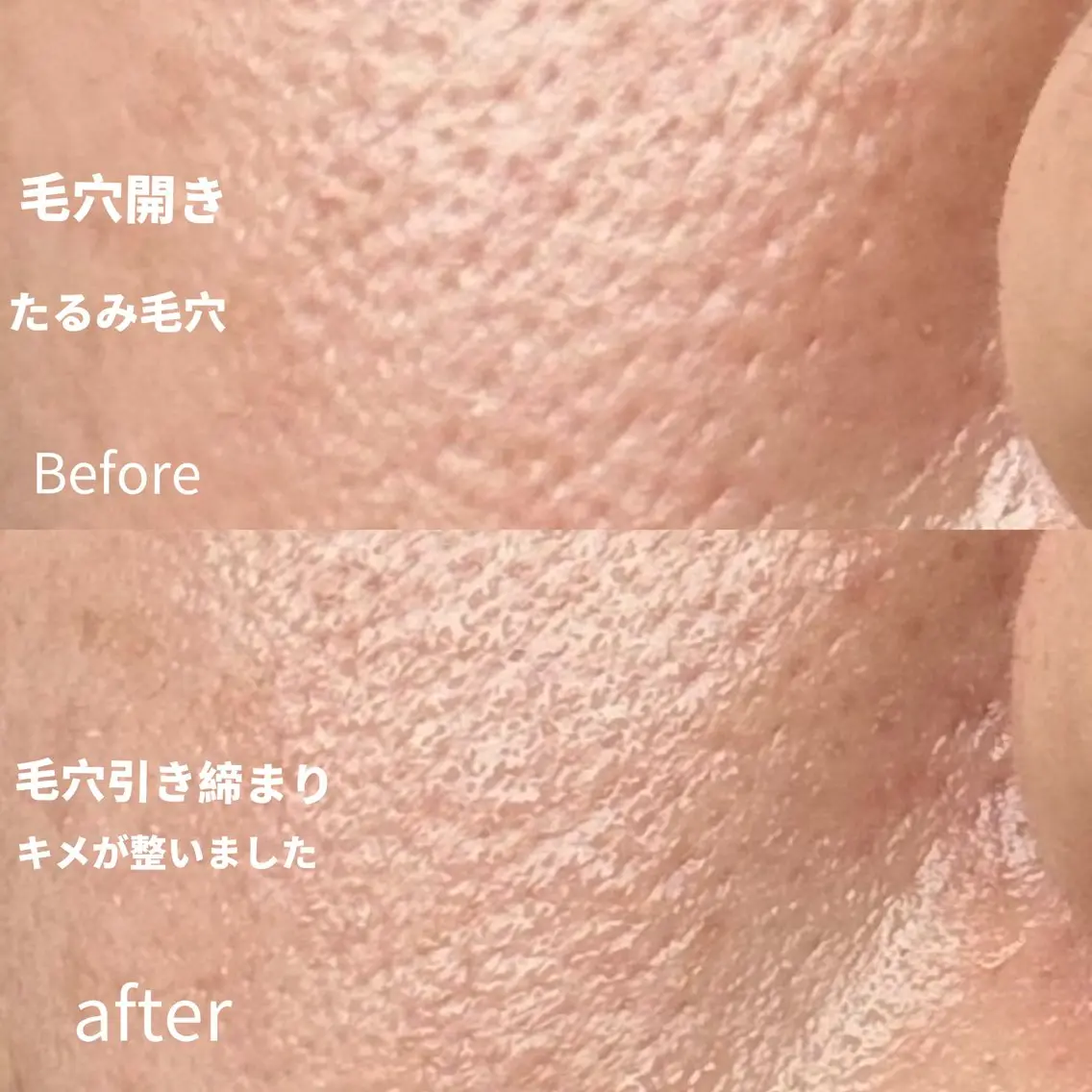 エステ Balance facialのその他イメージ