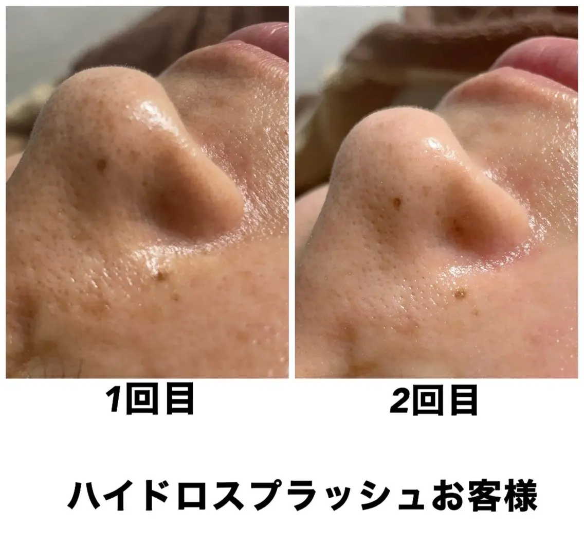 エステ リラク ネイル・エステサロン UILANIのエステ・リラクイメージ