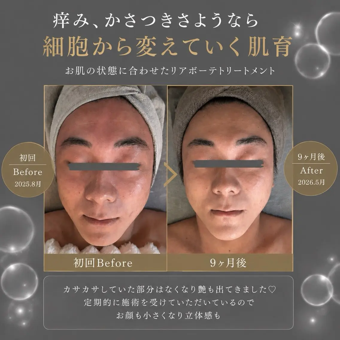 BLOSSOM 菊地幸子のエステ・リラクイメージ