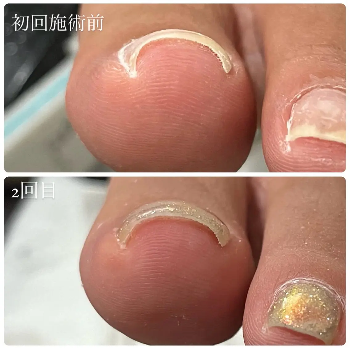 ネイル ジェルネイル フットネイル ネイルサロン kupuのネイルデザイン