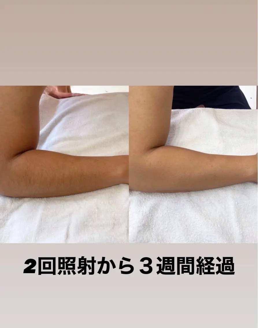 【本格脱毛】 グレイスフルルームのエステ・リラクイメージ
