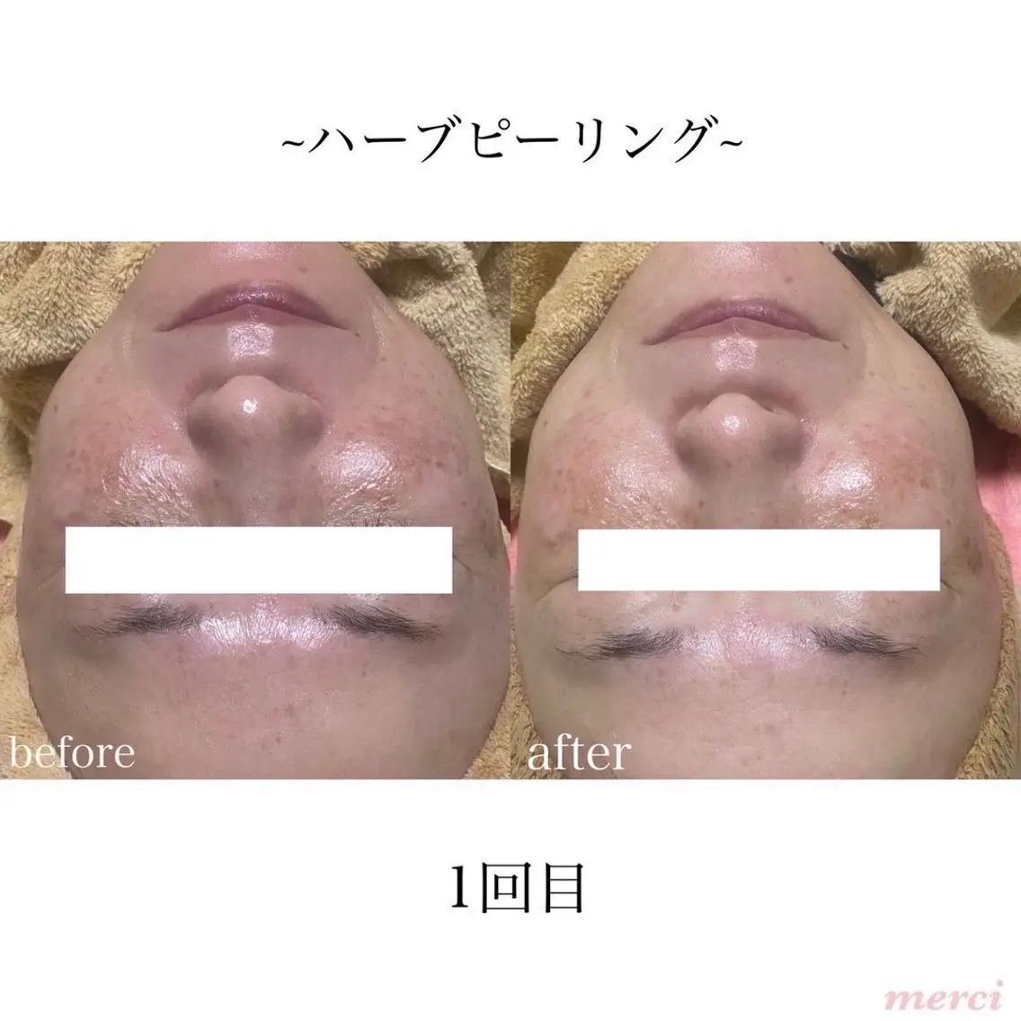 salon merci和泉のエステ・リラクイメージ