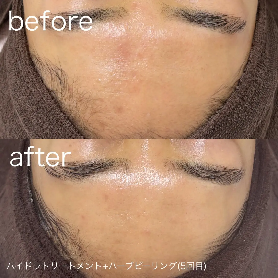 脱毛 lulularico Yuのネイルデザイン