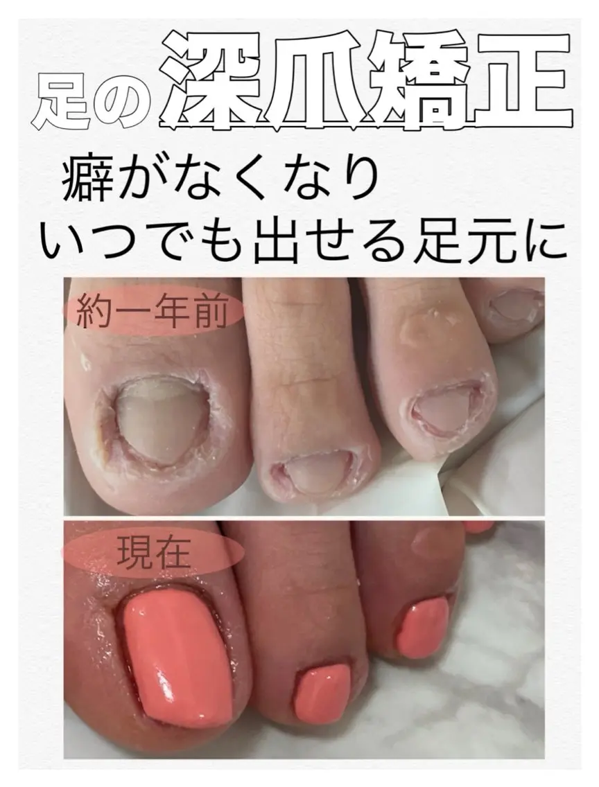 ネイル ジェルネイル フットネイル nail salon petillantのネイルデザイン