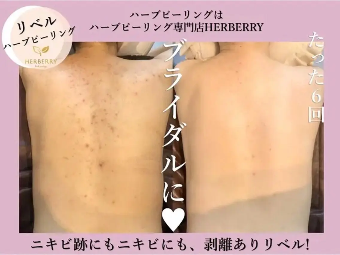 ハーブピーリング専門 HERBERRY冨永のエステ・リラクイメージ
