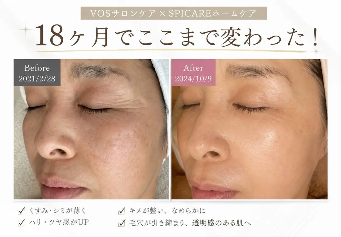 肌改善・脱毛・痩身 LuanaLifeのエステ・リラクイメージ