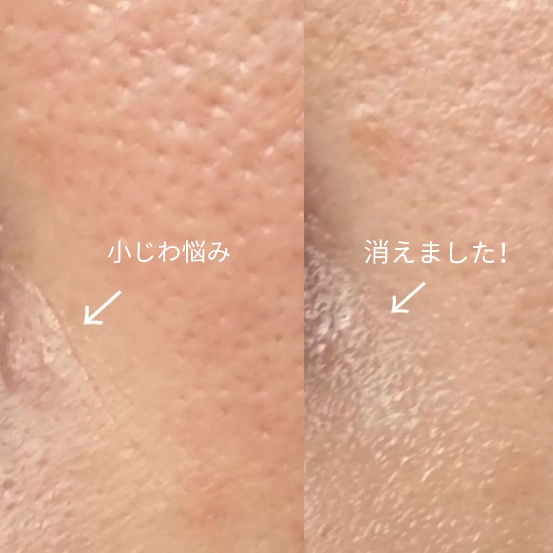 エステ リラク Balance facialのその他イメージ