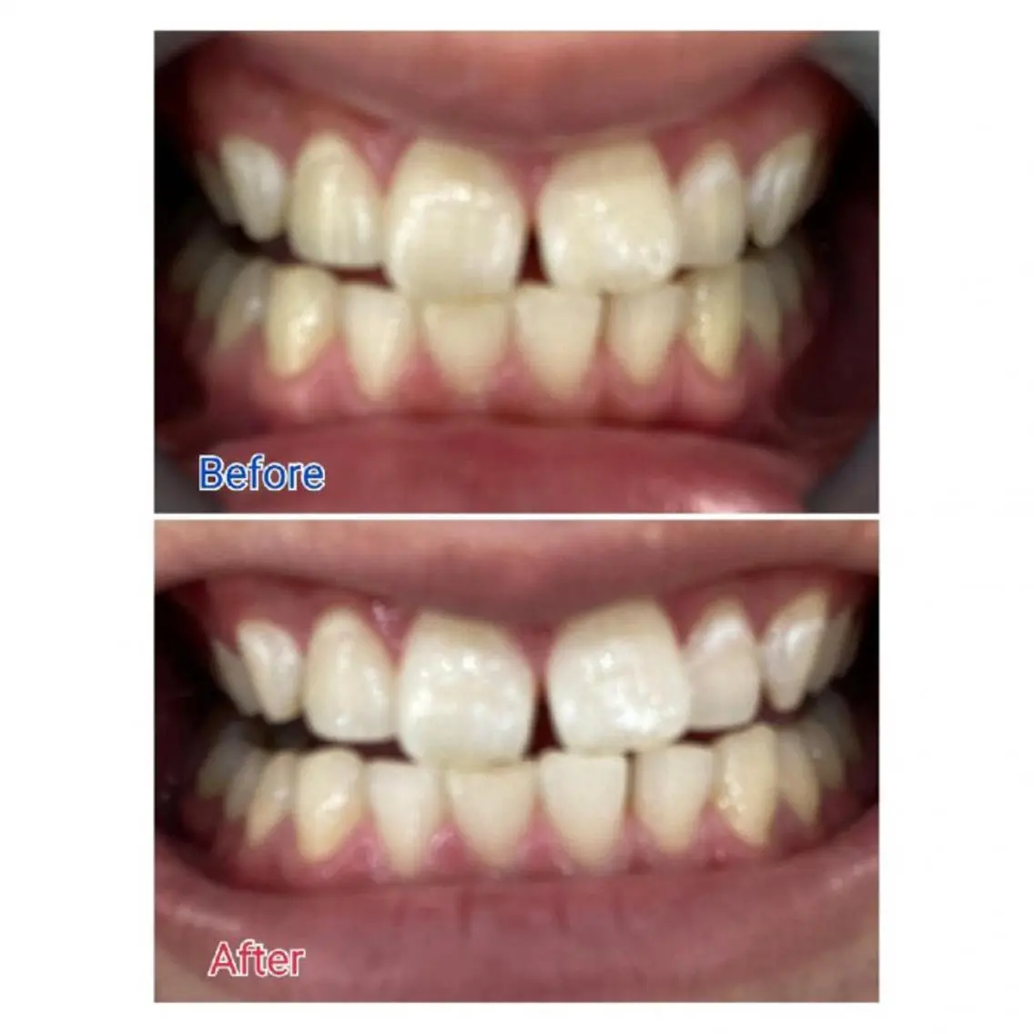 M渋谷 セルフホワイトニングのその他イメージ
