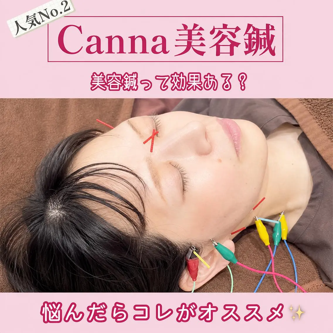 【美容鍼・小顔鍼】 鍼灸師 吉田洋美のエステ・リラクイメージ