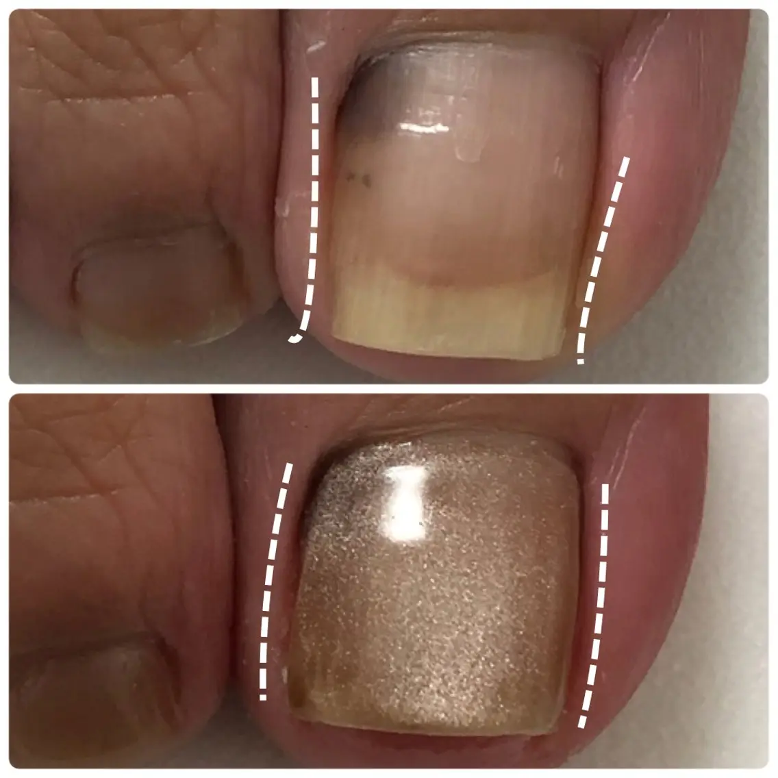 ネイル 自爪育成ネイルケア Lena  nailのネイルデザイン