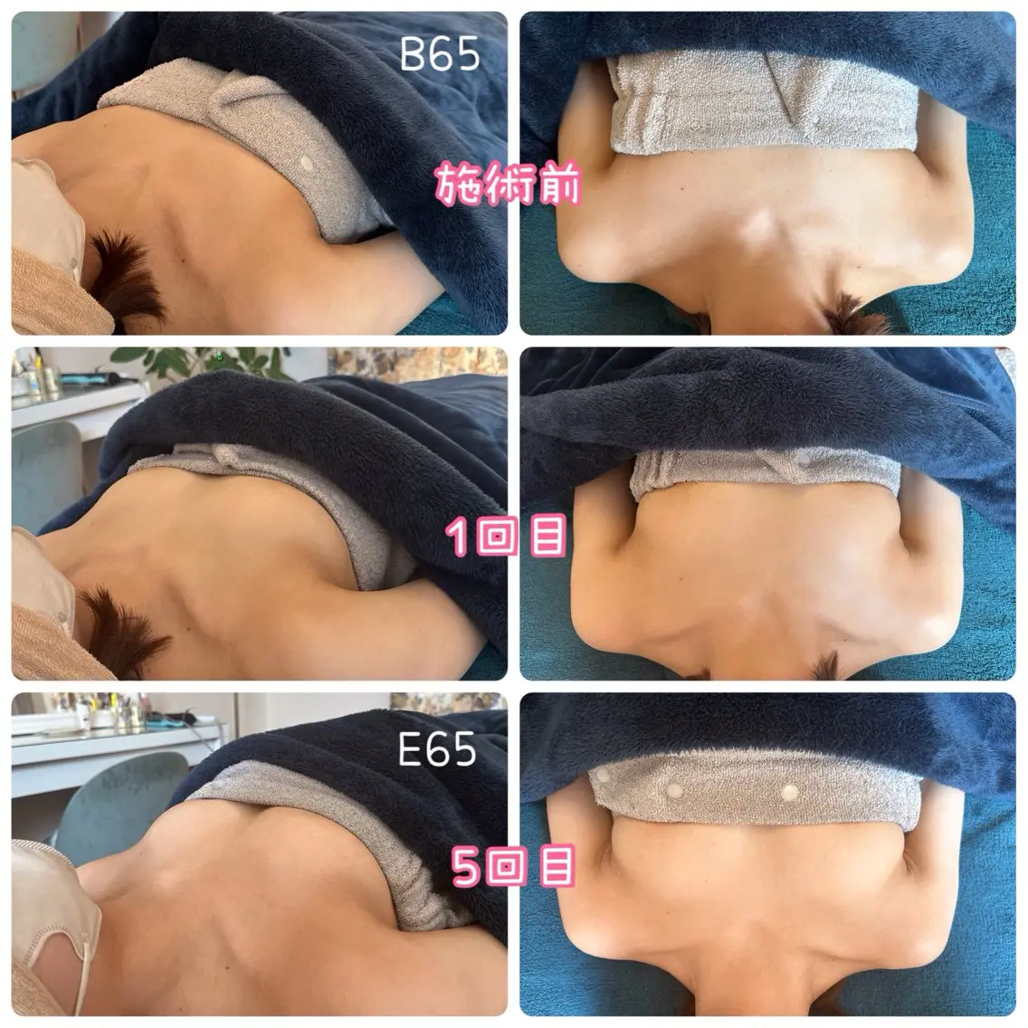 超お得🉐【バストアップモニター募集】6回コース5名の写真