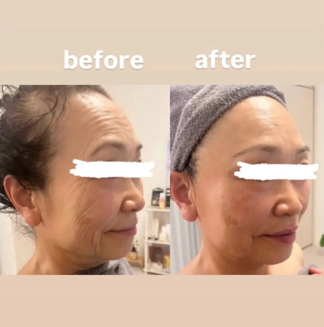エステ esthesalon O'-en-のエステ・リラクイメージ