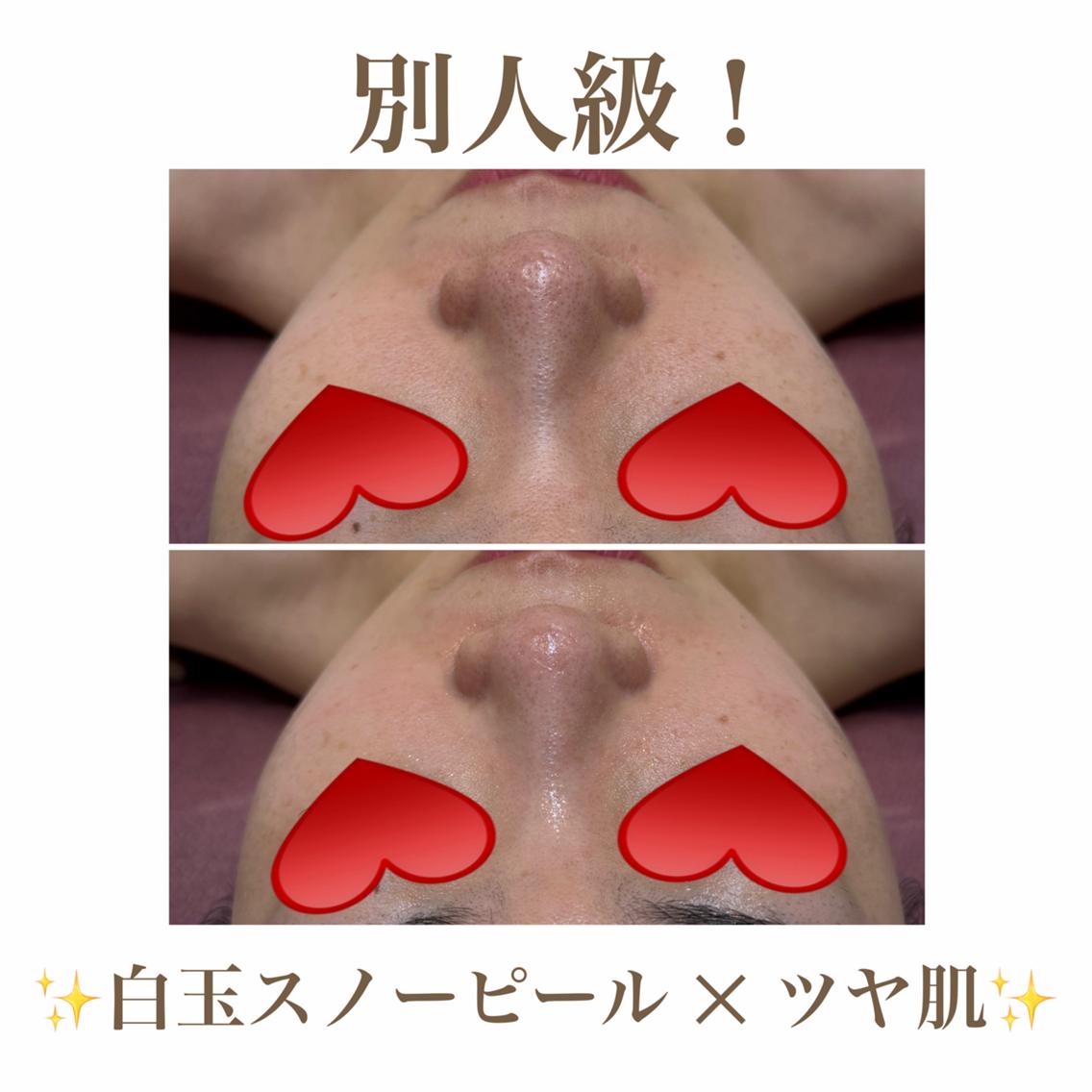 エステ 🫧美肌サロン🫧 レイビスひかる🧡のエステ・リラクイメージ