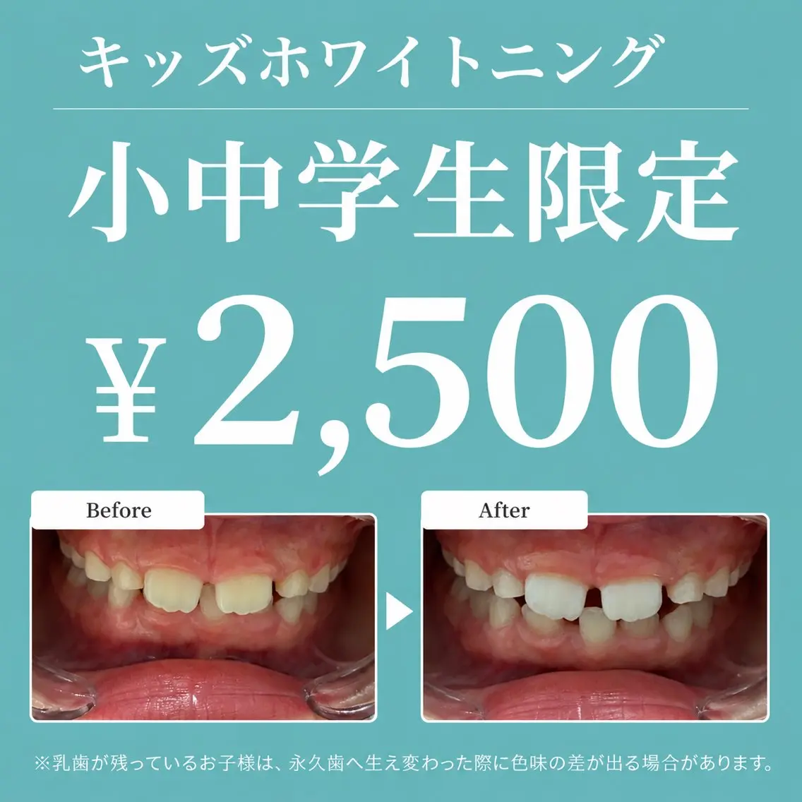 キッズ その他 Sky7 Total Beautyのその他イメージ