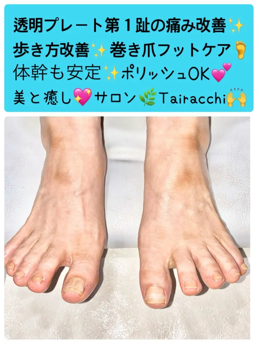 ネイル フットネイル Tairacchi タイラッチのエステ・リラクイメージ