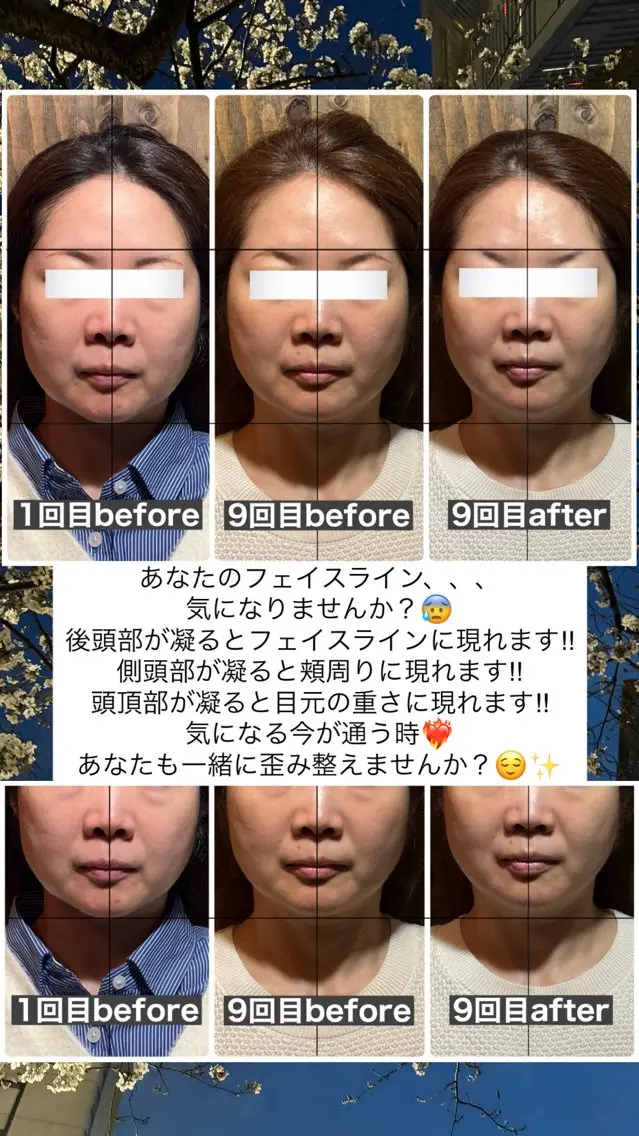 エステ リラク 💎後悔させない小顔 矯正💎イトヤマ🌱のエステ・リラクイメージ