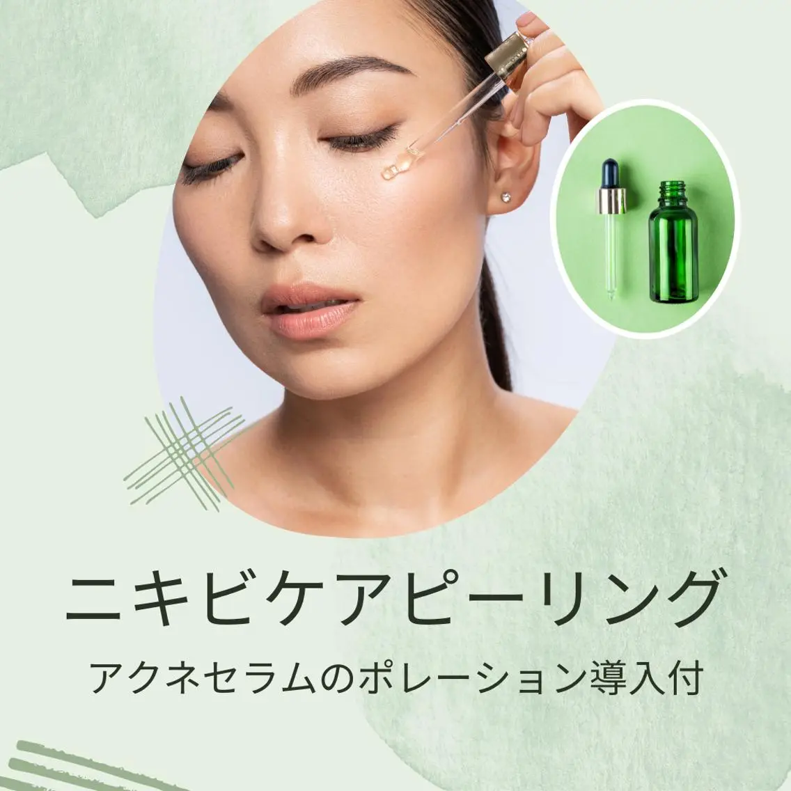 【毛穴・ニキビケア・肌質改善】ニキビケア乳酸ピーリング (剥離なし)＋アクネセラムポレーション導入の写真